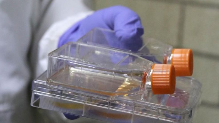 Crean nueva vacuna contra el virus del papiloma humano