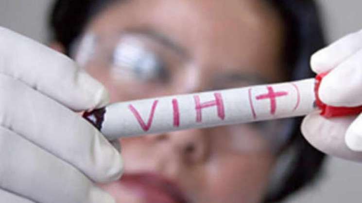 México registra 207 mil casos de VIH Sida desde 1983