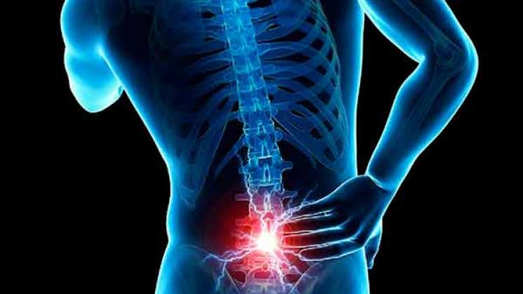 Riesgo de dolor lumbar por uso de computadoras y dispositivos