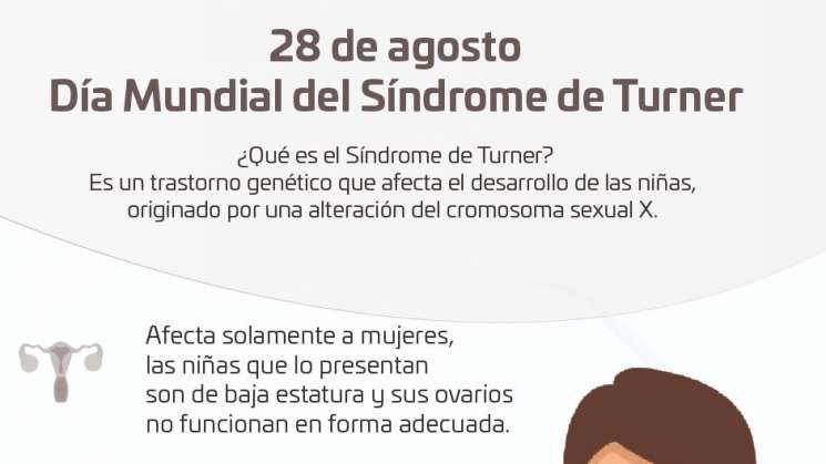 Síndrome de Turner, enfermedad genética que afecta a mujeres: SSO