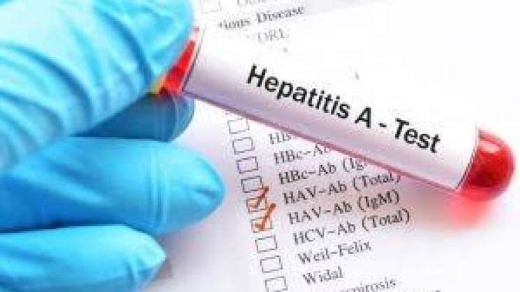 Hallan brote de hepatitis 