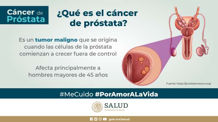 Invita Sedesa a hombres realizarse pruebas de antígeno prostático