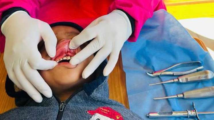 La prevención: el mejor tratamiento dental: SSO 