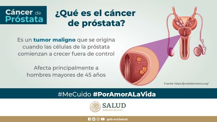  En México, 8 mil personas al año mueren por cáncer de próstata