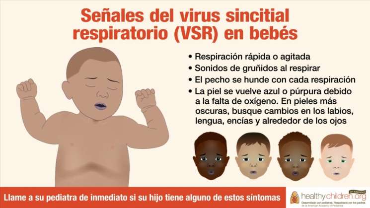 En México, aumentan casos de virus sincicial respiratorio 