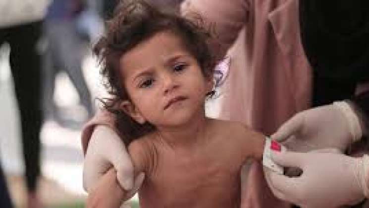 Confirman primeras muertes de niños por desnutrición en Gaza