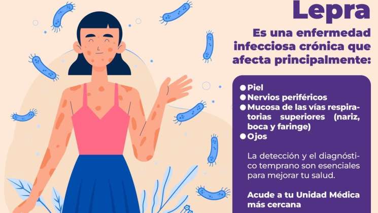    La lepra es prevenible y puede curarse con tratamiento   